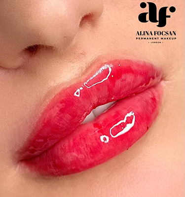 Lip Filler Lip Filler