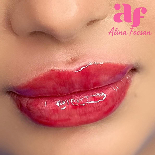 Lip Filler Lip Filler