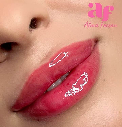 Lip Filler Lip Filler